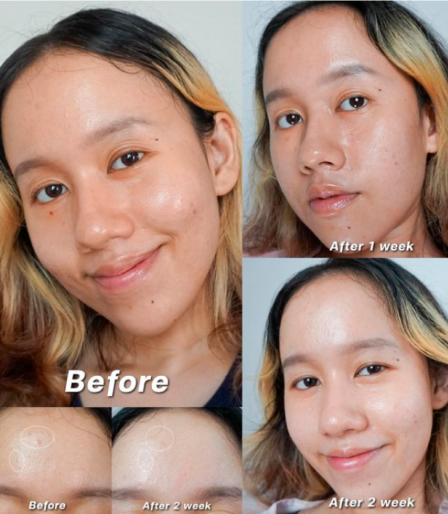 วีด้า เบลล่า ราณี VIDA GlutaMax ผิวขาว สวย กระจ่างใส ลดสิว ลดจุดด่างดำ กลูตาแม็กซ์ กลูต้า บำรุงผิว อาหารเสริม