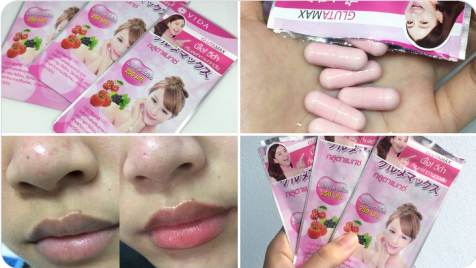 วีด้า เบลล่า ราณี VIDA GlutaMax ผิวขาว สวย กระจ่างใส ลดสิว ลดจุดด่างดำ กลูตาแม็กซ์ กลูต้า บำรุงผิว อาหารเสริม