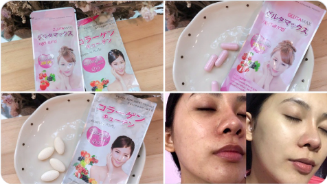 วีด้า เบลล่า ราณี VIDA GlutaMax ผิวขาว สวย กระจ่างใส ลดสิว ลดจุดด่างดำ กลูตาแม็กซ์ กลูต้า บำรุงผิว อาหารเสริม