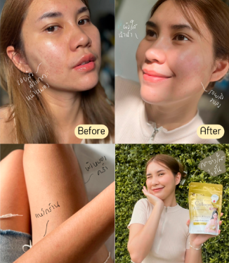 วีด้า เบลล่า ราณี VIDA Collagen ผิวขาว สวย กระจ่างใส ลดสิว ลดจุดด่างดำ คอลลาเจน บำรุงผิว บำรุงกระดูก ไขข้อ ข้อต่อ ผิวนุ่ม ชุ่มชื้น