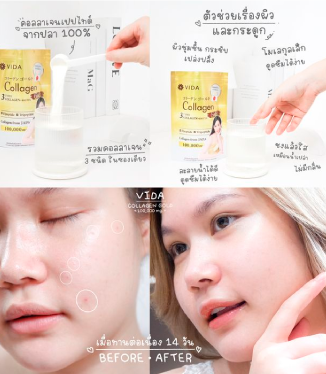 วีด้า เบลล่า ราณี VIDA Collagen ผิวขาว สวย กระจ่างใส ลดสิว ลดจุดด่างดำ คอลลาเจน บำรุงผิว บำรุงกระดูก ไขข้อ ข้อต่อ ผิวนุ่ม ชุ่มชื้น
