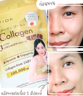 วีด้า เบลล่า ราณี VIDA Collagen ผิวขาว สวย กระจ่างใส ลดสิว ลดจุดด่างดำ คอลลาเจน บำรุงผิว บำรุงกระดูก ไขข้อ ข้อต่อ ผิวนุ่ม ชุ่มชื้น