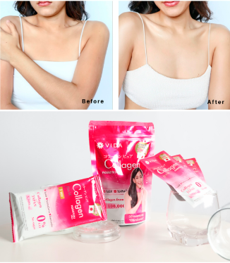 วีด้า เบลล่า ราณี VIDA Collagen ผิวขาว สวย กระจ่างใส ลดสิว ลดจุดด่างดำ คอลลาเจน บำรุงผิว บำรุงกระดูก ไขข้อ ข้อต่อ ผิวนุ่ม ชุ่มชื้น