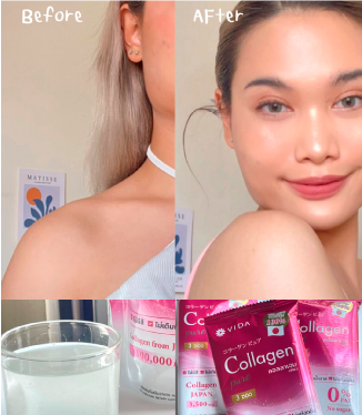 วีด้า เบลล่า ราณี VIDA Collagen ผิวขาว สวย กระจ่างใส ลดสิว ลดจุดด่างดำ คอลลาเจน บำรุงผิว บำรุงกระดูก ไขข้อ ข้อต่อ ผิวนุ่ม ชุ่มชื้น