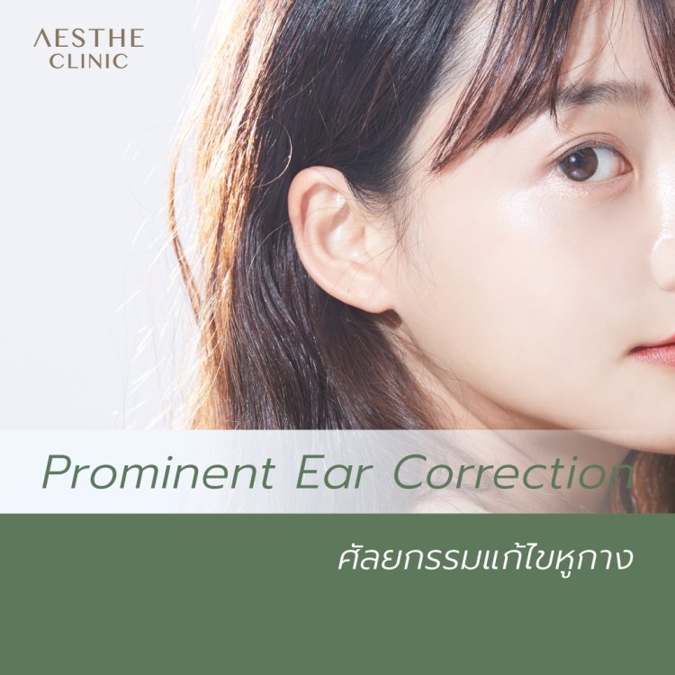 ศัลยกรรมแก้ไขหูกาง