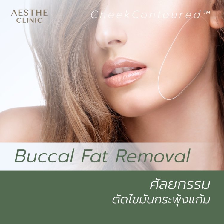 ศัลยกรรมตัดไขมันกระพุ้งแก้ม
