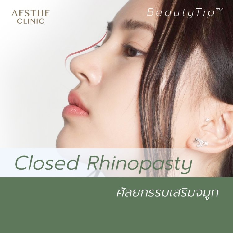 ศัลยกรรมเสริมจมูก