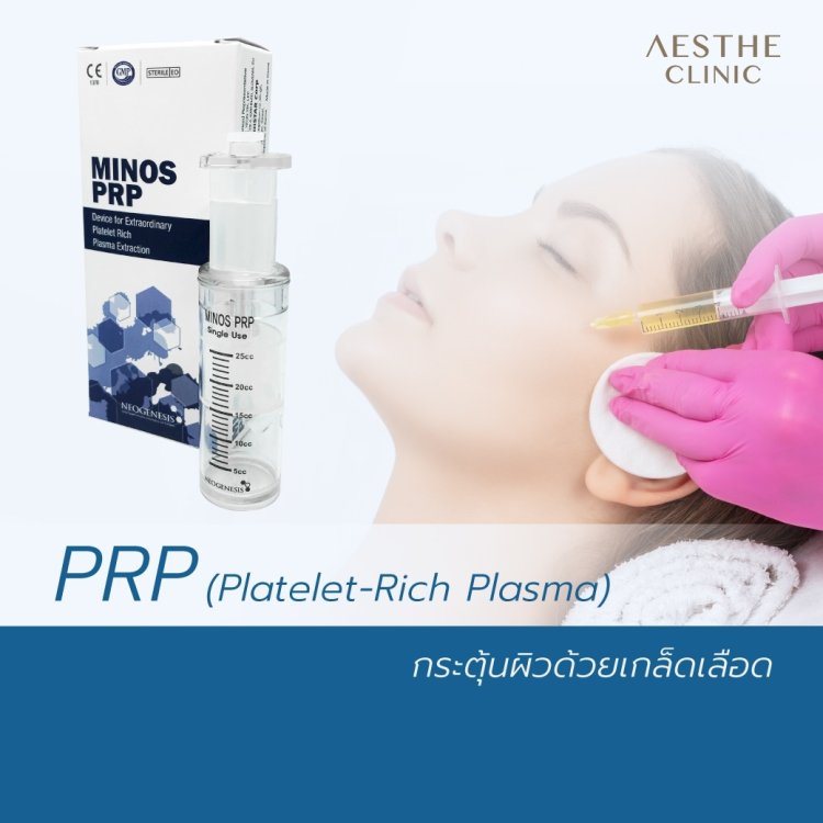 PRP กระตุ้นผิวด้วยเกล็ดเลือด