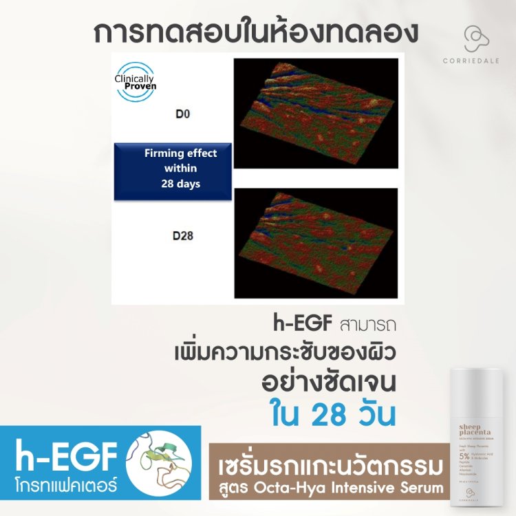 เซรั่มรกแกะนวัตกรรม ด้วยรกแกะอนุภาคนาโน ผสานไฮยาลูรอน 8 โมเลกุล เข้มข้นสูง 5%