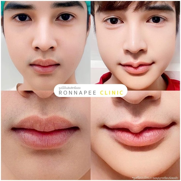 ทำปากกระจับ