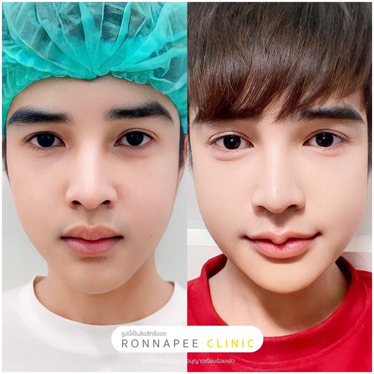 ปากกระจับ