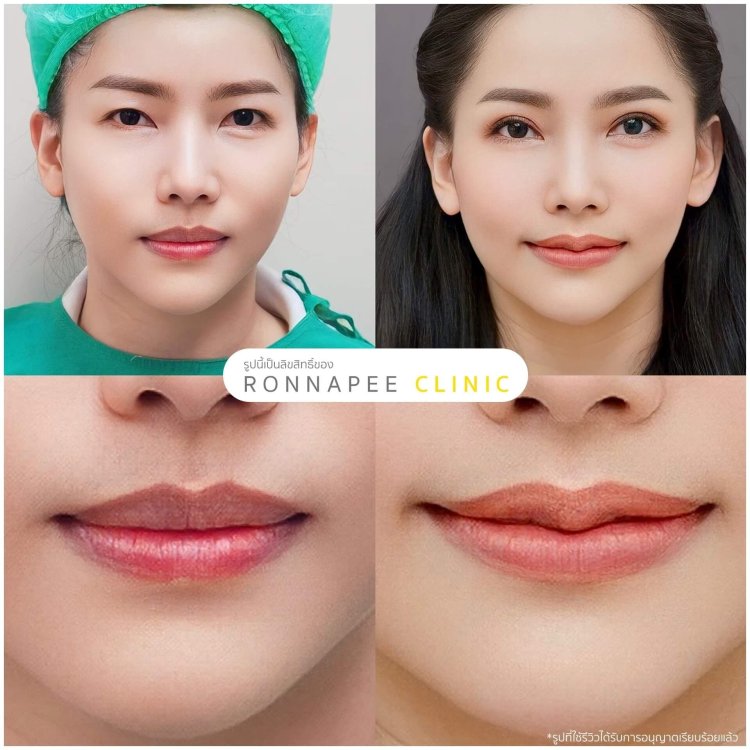 ทำปากกระจับ