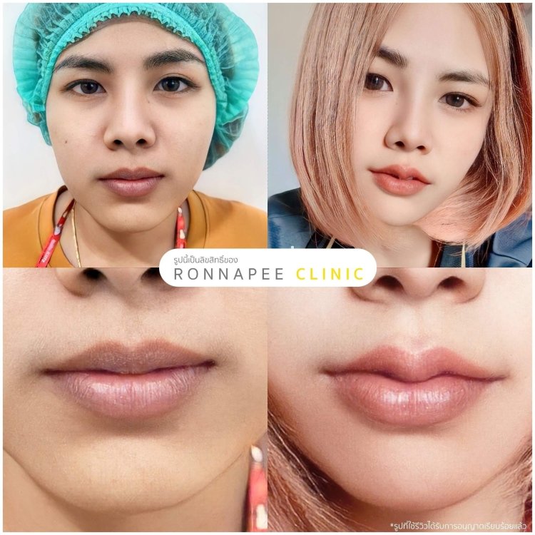 รีวิวทำปากกระจับ