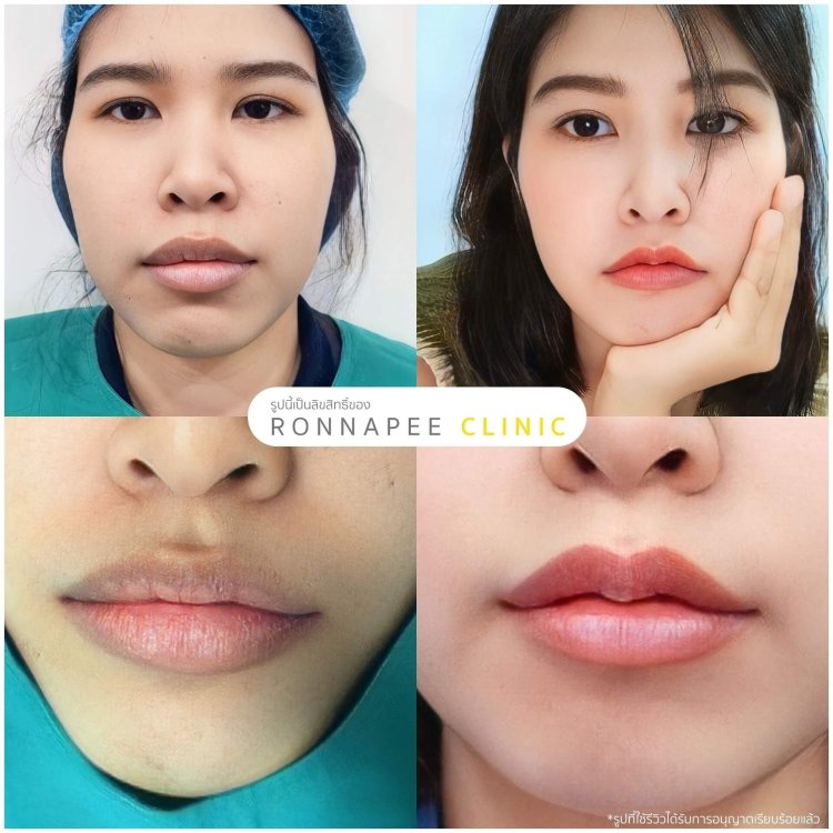 รีวิวทำปากกระจับ