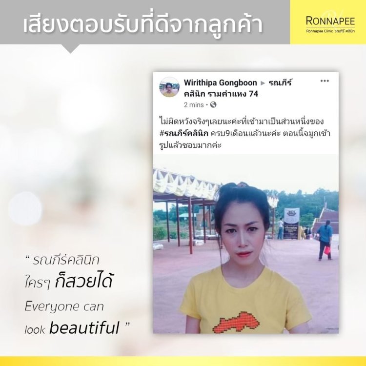 รีวิวทำจมูก รณภีร์คลินิก
