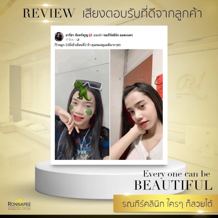 เสียงตอบรับจากลูกค้า RPC