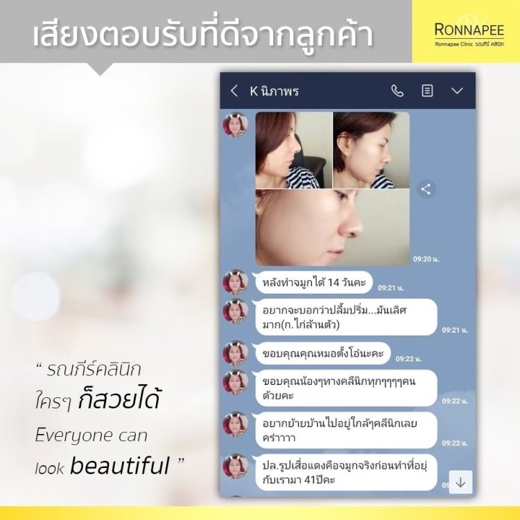 รีวิวเสริมจมูกที่  RonnapeeClinic