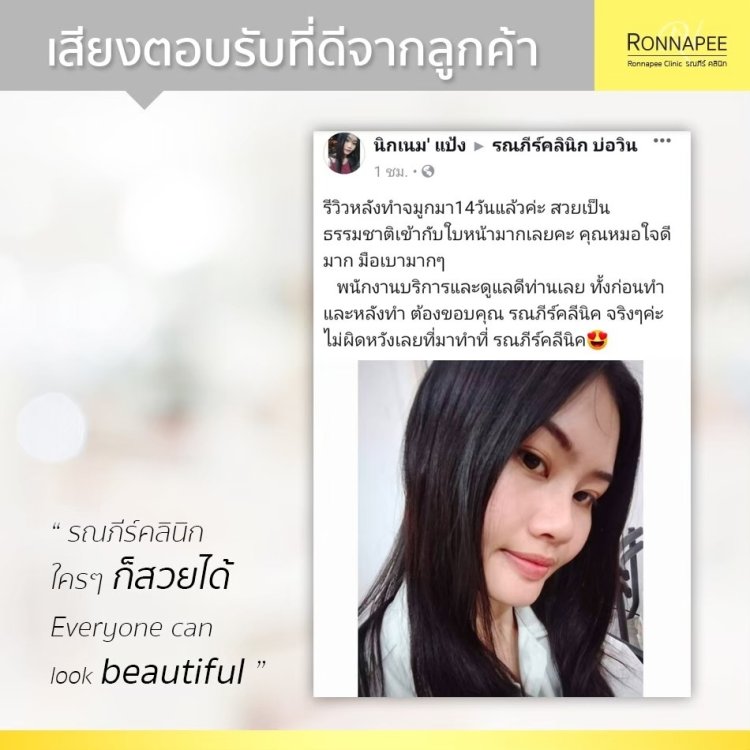 รีวิวทำจมูก RonnapeeClinic