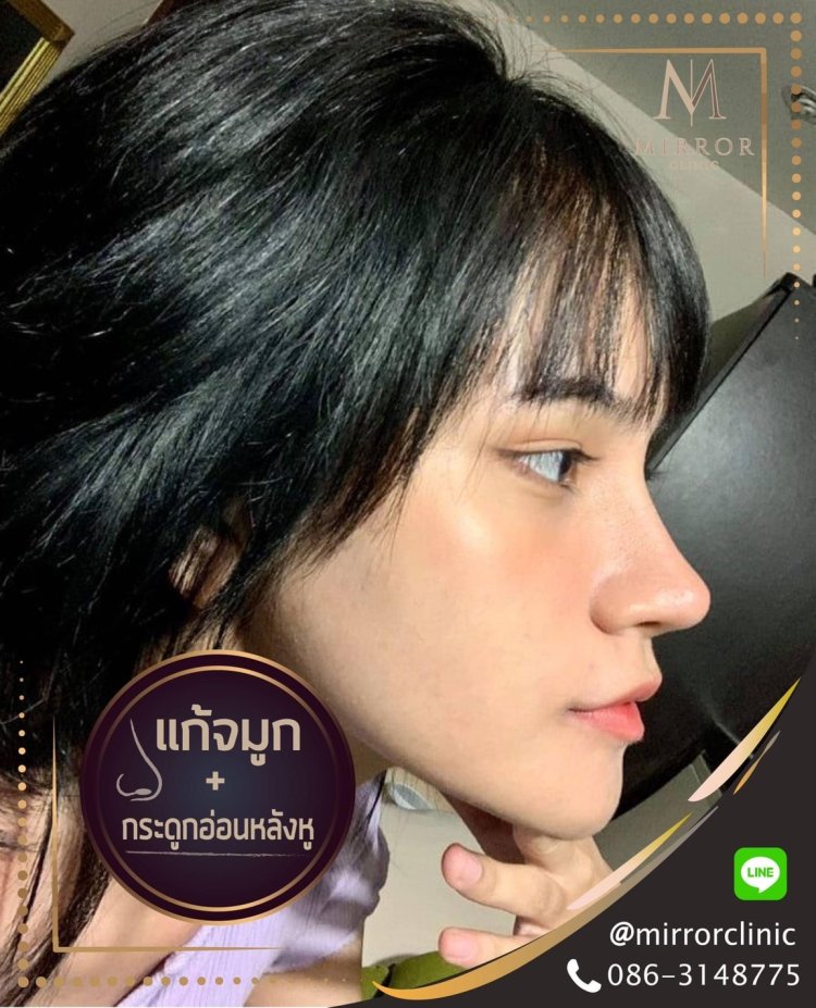 สโลปปลายพุ่ง