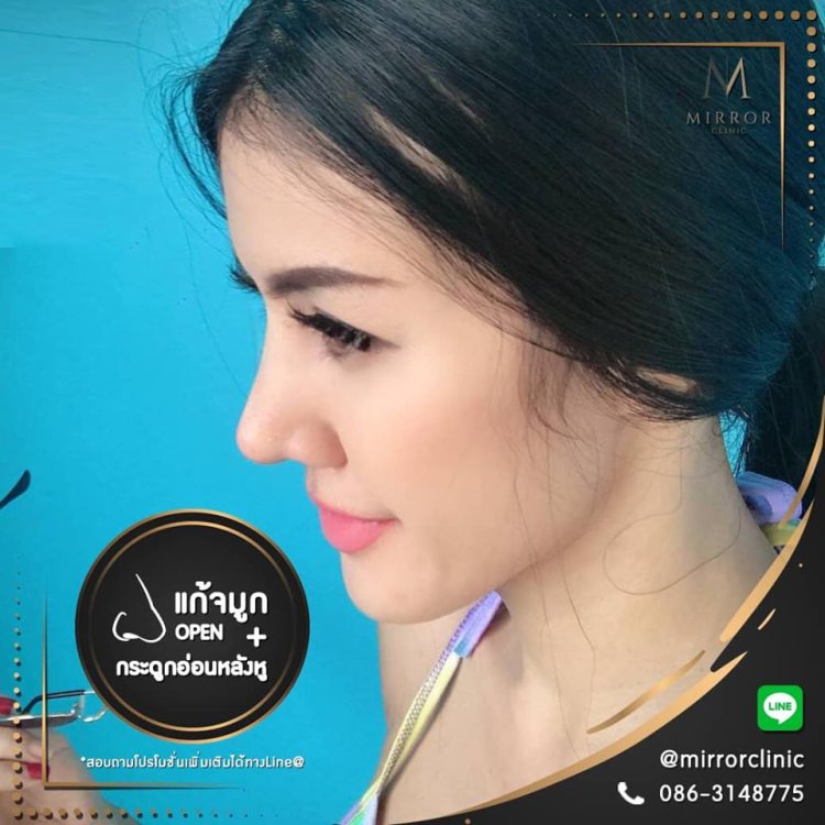 ทรงหยดน้ำ