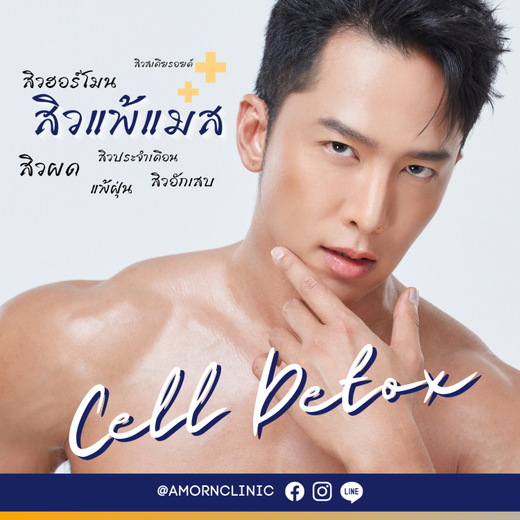 รักษาสิว