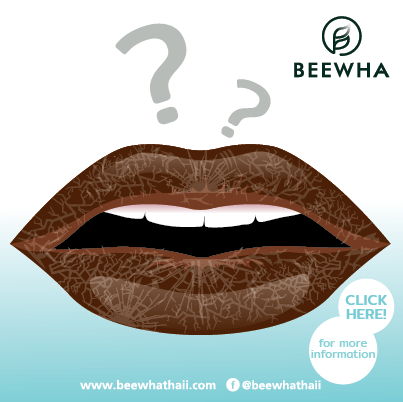 บทความ ทำไมปากดำคล้ำและแห้งแตก??