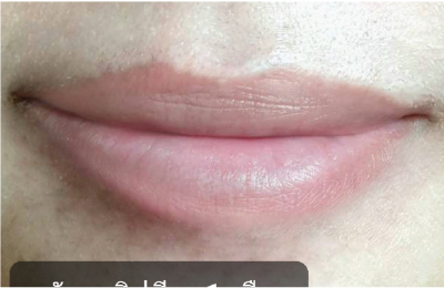 ริมฝีปากคุณดาหลังทาบีวาโมจิลิปบาล์มกลิ่นมินต์ 1 เดือน