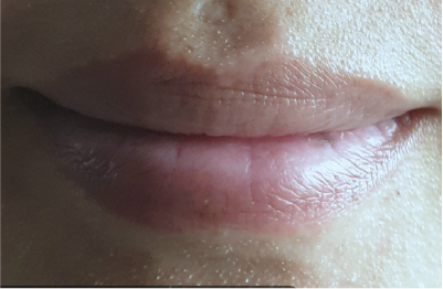 ริมฝีปากคุณดาหลังทาบีวาโมจิลิปบาล์มกลิ่นมินต์ 1 สัปดาห์