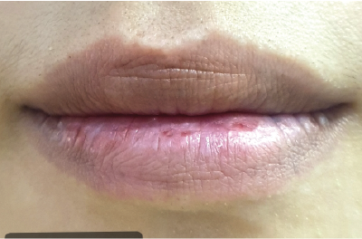 ริมฝีปากคุณดาก่อนทาบีวาโมจิลิปบาล์มกลิ่นมินต์