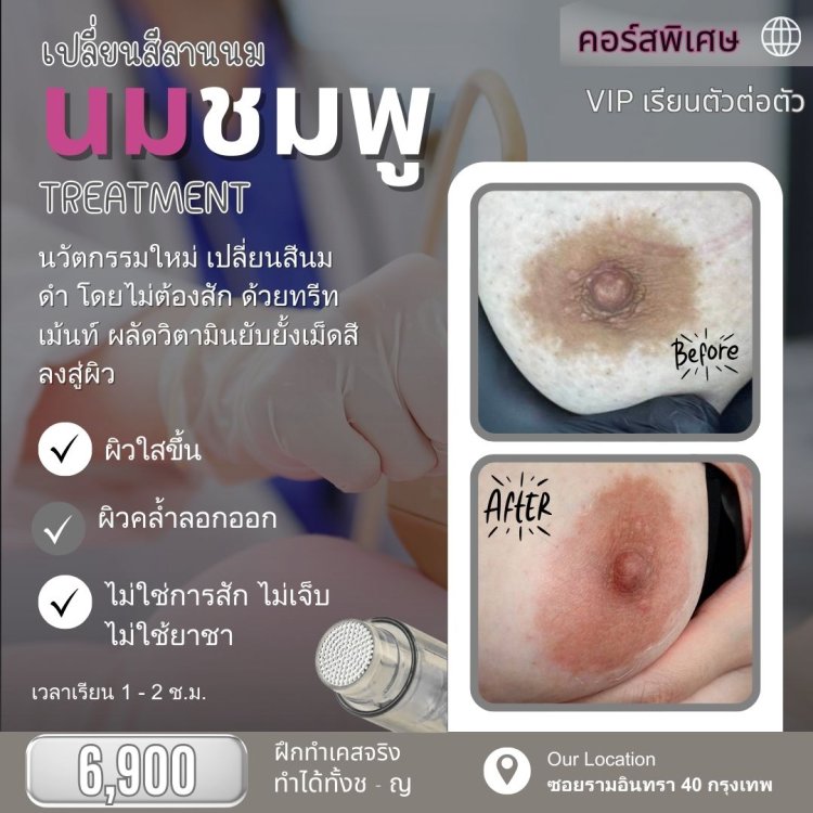 สักนมชมพู แก้นมดำ 