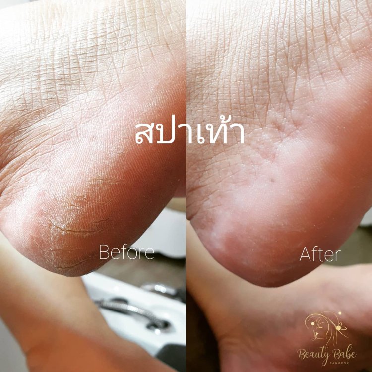 Beautyparadisebkk เราให้บริการด้านความงาม ทำเล็บ ต่อขนตา ฝังสีคิ้ว ฝังสีปาก แก้ไขความบกพร่องด้วยการสักเพื่อความงาม โดยผู้เชี่ยวชาญประสบการณ์กว่า 10 ปี