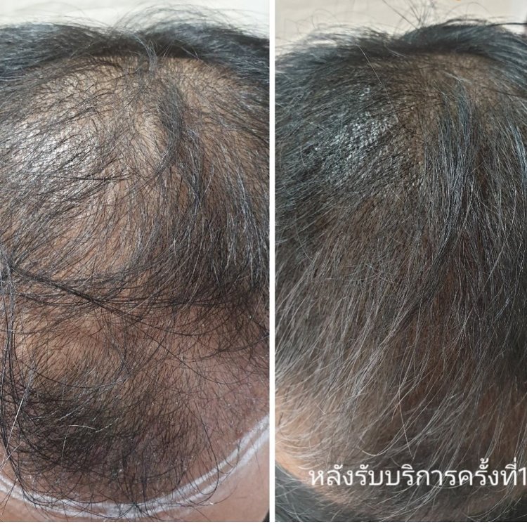 Beautyparadisebkk เราให้บริการด้านความงาม ทำเล็บ ต่อขนตา ฝังสีคิ้ว ฝังสีปาก แก้ไขความบกพร่องด้วยการสักเพื่อความงาม โดยผู้เชี่ยวชาญประสบการณ์กว่า 10 ปี