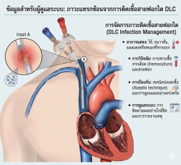 ภาวะการติดเชื้อในสายฟอกไตDLC 