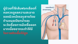 การปฏิบัติตัวหลังเข้ารับการฟอกเลือด