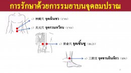 การดูแลสุขภาพในผู้ชายวัยกลางคนขึ้นไป