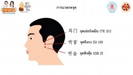 เสียงในหูและหูดับแพทย์จีนมีทางออก