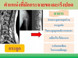 มะเร็งปอด โรคภัยใกล้ตัว ป้องกันดูแลรักษาด้วยวิธีแพทย์จีน