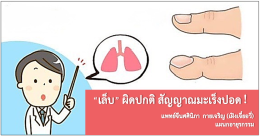 เล็บ ผิดปกติ สัญญาณมะเร็งปอด！