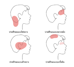 เข้าใจอาการปวดศีรษะ.....สัญญาณเตือนจากร่างกาย