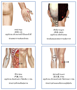 ฝังเข็มรักษาภูมิแพ้จมูกได้อย่างไร?