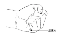 Office syndrome และบทบาทการฝังเข็ม