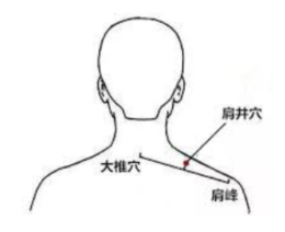 Office syndrome และบทบาทการฝังเข็ม