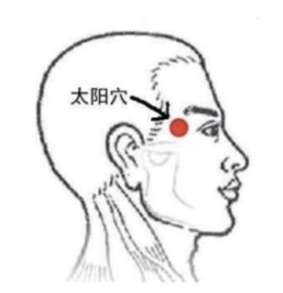 Office syndrome และบทบาทการฝังเข็ม