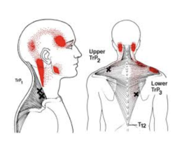 ปวดกล้ามเนื้อทำไมนวดเองไม่หาย