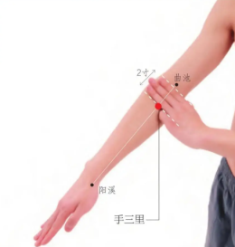 อาการปวดข้อมือคุณแม่ Mommys Wrist เพราะมือที่ดูแลลูกก็ควรได้รับการดูแลเช่นกัน
