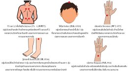 การฝังเข็มรักษาอาการติดบุหรี่ สุราและสารเสพติดได้อย่างไร