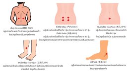 ไขข้อข้องใจทำไมผู้หญิงหลังหมดประจำเดือนถึงมีอาการปัสสาวะแสบขัด ปัสสาวะเล็ด และปัสสาวะบ่อย