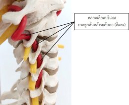 อาการเวียนศีรษะเรื้อรังจากภาวะกระดูกสันหลังส่วนคอเสื่อม (Cervicogenic Dizziness)