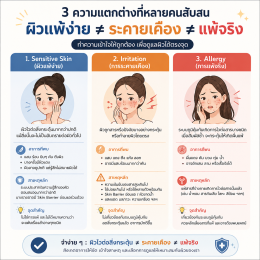 ผิวแพ้ง่าย คืออะไร? แพ้ครีมหรือแค่ระคายเคือง ต่างกันอย่างไร