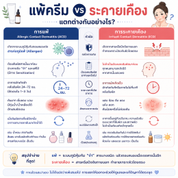 กลไกการแพ้ครีม การแพ้ครีมเกิดขึ้นได้อย่างไร ใช้ครีมแล้วแสบหน้า อาจไม่ใช่การแพ้